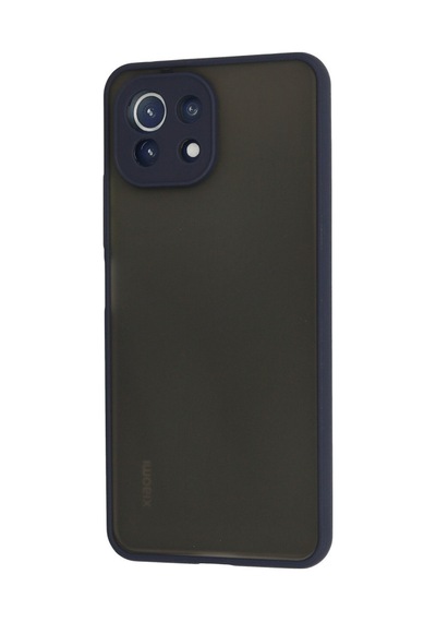 Xiaomi Mi 11 Lite Uyumlu Kılıf Montreal Silikon Kapak - Lacivert