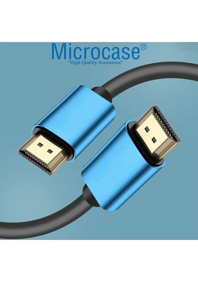 Microcase Yüksek Hızlı 4k Ultra Hd Hdmı Kablo 3 Metre - Al3772