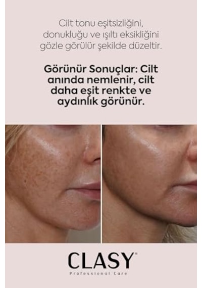 Clasy Care Aydınlatıcı Yüz Kremi Cilt Tonu Eşitleyici Ve Canlandırıcı Bakım Koyu Leke Görünümü Karşıtı Günlük Nemlendirici, 100 Ml