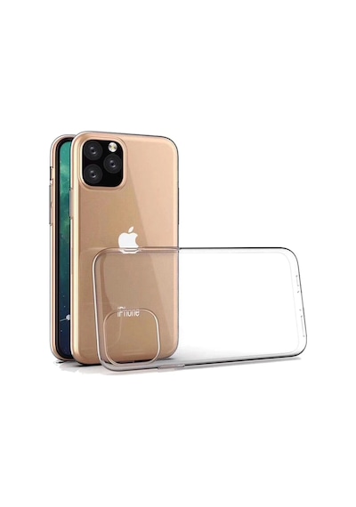 Gld-spt- Newface Apple Uyumlu iPhone 11 Pro Max Kılıf Lüx Şeffaf Silikon