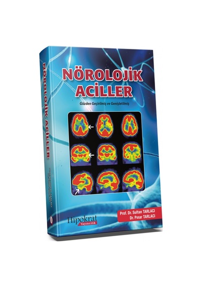 Nörolojik Aciller