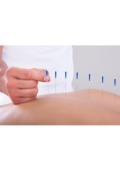 Maxi Akupunktur Iğnesi Kuru Iğne, Acupuncture Needle 0,35*60Mm Çok Renkli