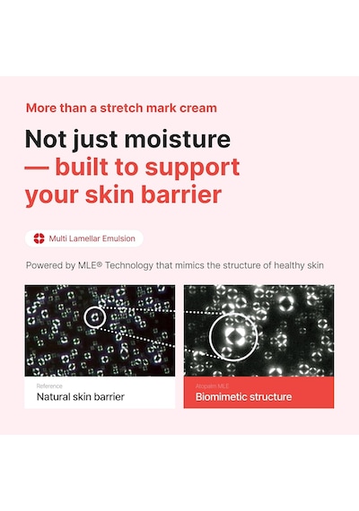 Hamilelere Özel Yoğun Nemlendirici&besleyici Çatlak Kremi Maternity Care Stretch Mark Cream