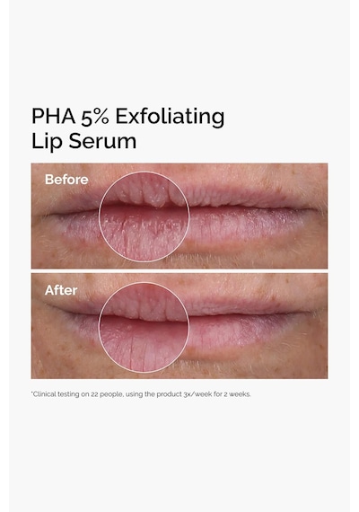 The Ordinary Pha %5 Peeling Etkili Dudak Serumu 15ml