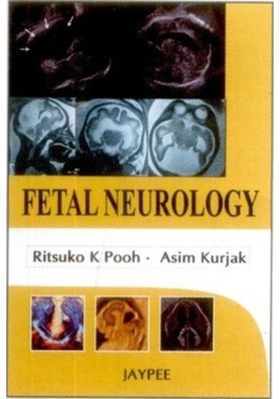 Fetal Neurology - Jaypee