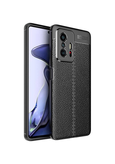 Xiaomi Mi 11T 5G Kılıf Zore Niss Deri Desenli Silikon Kılıf