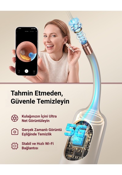 Bebird Ultra X 2k Hd Kameralı Akıllı Kulak Temizleme Ve Bakım Cihazı Hediye Kutulu