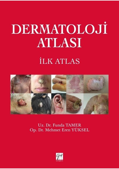 Dermatoloji Atlası: İlk Atlas