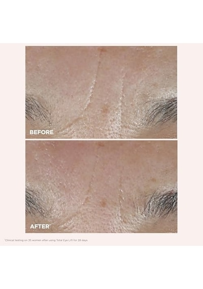 Total Eye Lift Göz Kremi 15 Ml