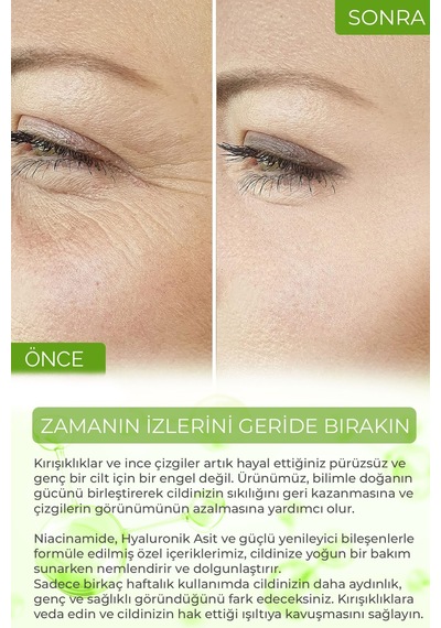 Siyah Nokta Karşıtı Ve Leke Karşıtı Yüz Bakım Serumu 2 Li Set