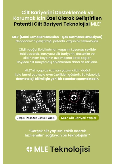 Aşırı Kuru Ve Hassas Ciltlere Bariyer Desteği Sunan Yoğun Bakım Kremi Zeroıd Intensive Oint-cream
