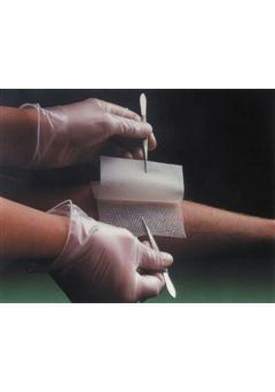 Smith&Nephew Bactigrass Antiseptik Tül Gras Sargı 10 CM x 10 CM