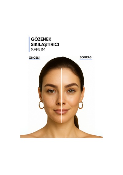Mia Klinika Gözenek ve Siyah Nokta Gidermeye Yardımcı Serum 30 ML