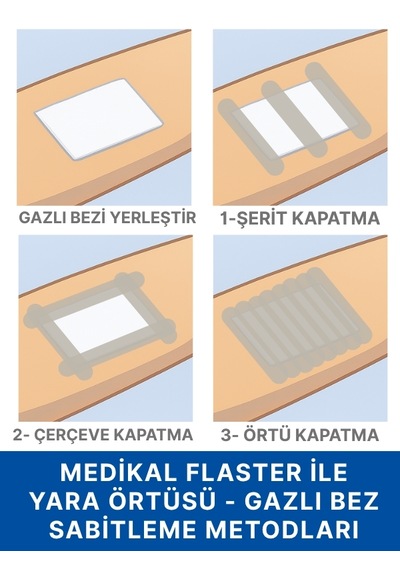 Pe 1,25cm X 5m Şeffaf Perforeli Flaster. Hipoalerjenik, Nefes Alabilen, Cilde Dost, Suya Dayanıklı