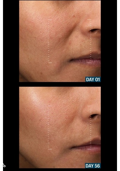 Allies Of Skin Leke Karşıtı, Aydınlatıcı, Peptit Ve Gümüş Içerikli Gece Serumu