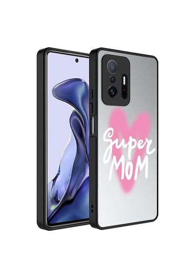 Xiaomi Mi 11t 5g Kılıf Aynalı Desenli Kamera Korumalı Parlak Zore Mirror Kılıf