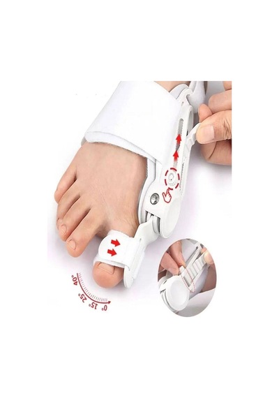 Ayarlanabilir Ayak Baş Parmak Kemik Düzeltici - Halluks Valgus Bunyon Aparatı