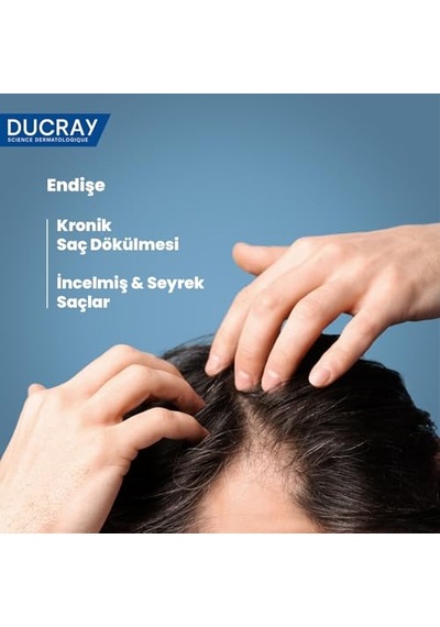 Anaphase +plus Shampoo 100ml 1 Paket