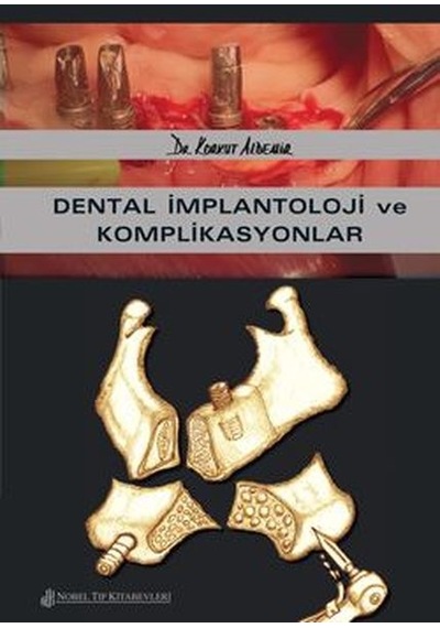 Dental İmplantoloji ve Komplikasyonlar- Nobel Tıp Kitabevleri