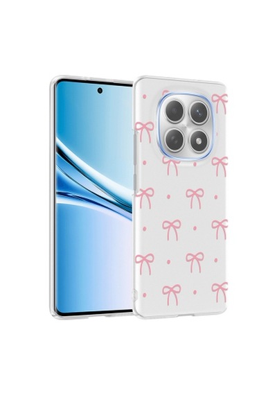 Xiaomi Redmi Note 14 Pro 4g Kılıf Kamera Korumalı Desenli Zore Klip Kapak Xiaomi Redmi Note 14 Pro 4g Zore - Fiyonk