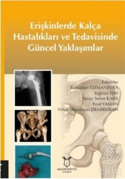 Erişkinlerde Kalça Hastalıkları ve Tedavisinde Güncel Yaklaşımlar- Akademisyen Kitabevi