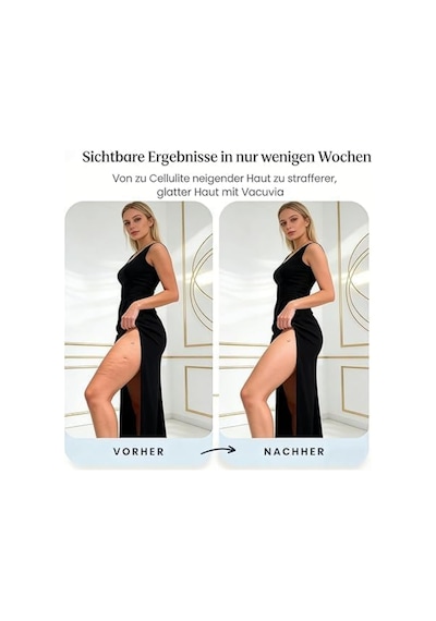 Nordicshape Masaj Aleti Cellusmooth - Selülit Azaltma İçin Isı Terapili Anti Selülit Vakum Masajı Altın