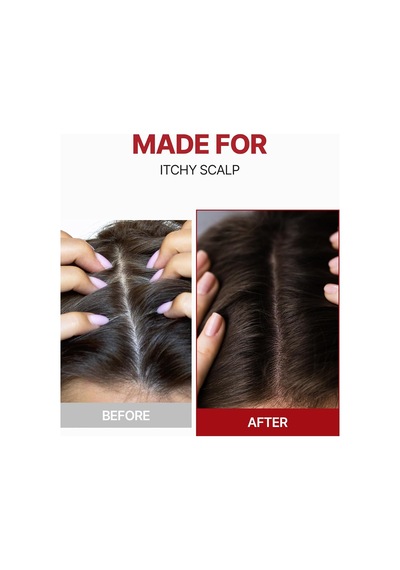 Kafeinli Dökülme Karşıtı Saç Güçlendirici Tonik Head Spa & Scalp Care Caffeine Scalp Tonic