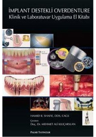 İmplant Destekli Overdenture Klinik Ve - Palme Yay