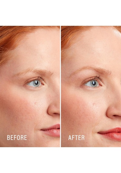 Rötuş Eksfoliye Edici Dermaplaning Aleti, Yüz Ve Kaş Tıraş Makinesi Hassas Kapaklı - 9 Adet Kadınlar İçin Dermaplaning Jilet