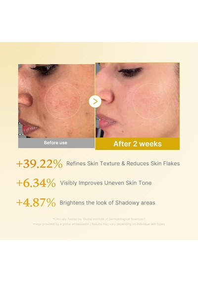 Medıcube Kojic Acid Turmeric Smoothing Toner 250 Ml Kojik Asit Zerdeçal Niasinamid Glikolik Asit Tonik Kbeautyflashsale
