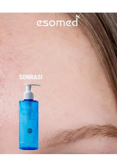 Esomed Yüz Temizleme Jeli 200 Ml