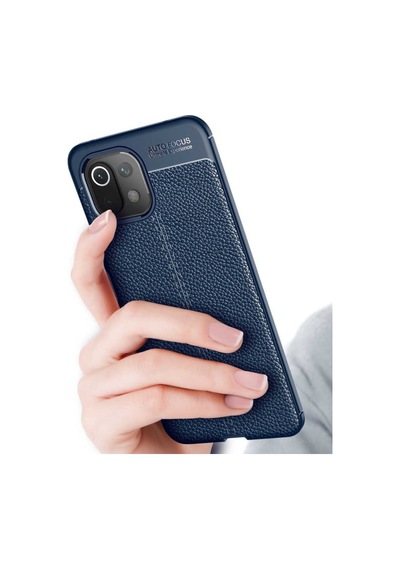 Xiaomi Mi 11 Lite Kılıf Deri Tarzı Niss Silikon Case