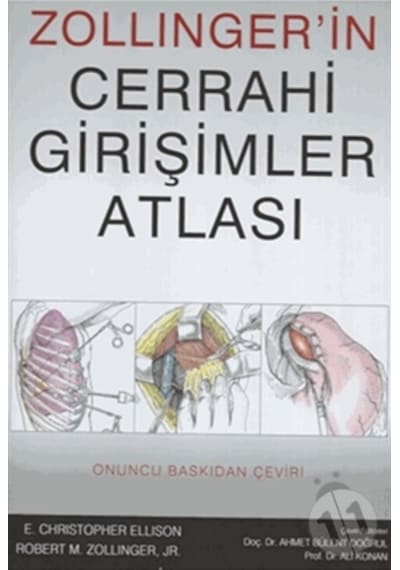 Zollınger'İn Cerrahi Girişimler Atlası Palme