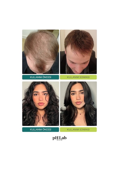 Phlab Hair Pdrn Nad+ & Exosome Hair & Scalp Care Şampuan 250 ML