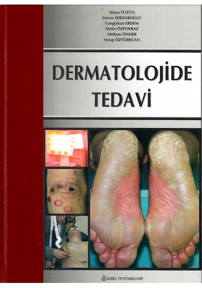 Dermatolojide Tedavi N11.1801