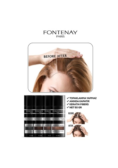 Saç Dolgunlaştırıcı Keratin Fibers Açık Kahve Topik Saç Tozu 50gr + Saç Spreyi 400ml 2'li S Renkli