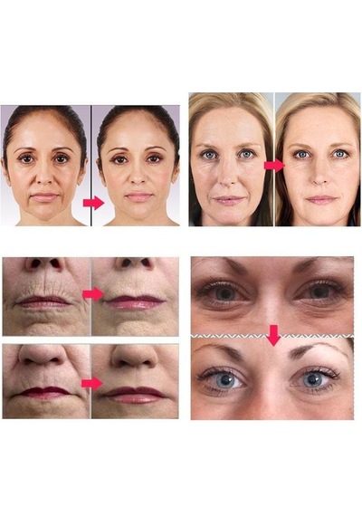 Roller Derma Cilt Yenileme Bakım Seti