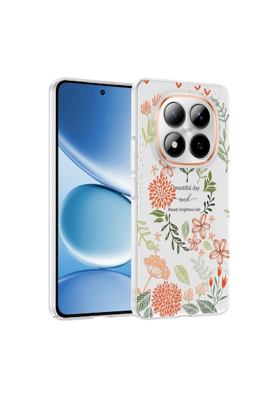 Redmi Note 15 Pro 4g Kılıf Kamera Korumalı Desenli Zore Klip Kapak - Beautiful -