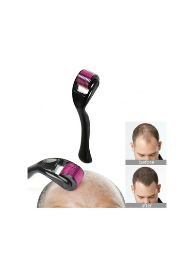 Zensaas41 Derma Roller 0.5 Mm Titanyum İğneli Cilt Bakım Aleti Zensaa56