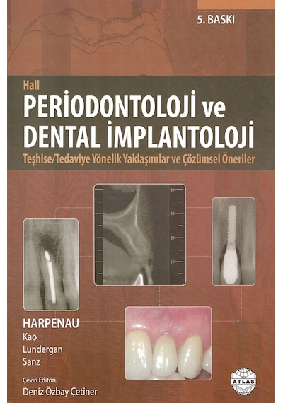 Periodontoloji Ve Dental İmplantoloji - Hall