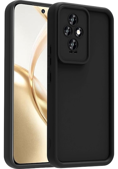Honor 200 Uyumlu Kılıf Kamera Korumalı Sys Ananas Kapak - Siyah Siyah
