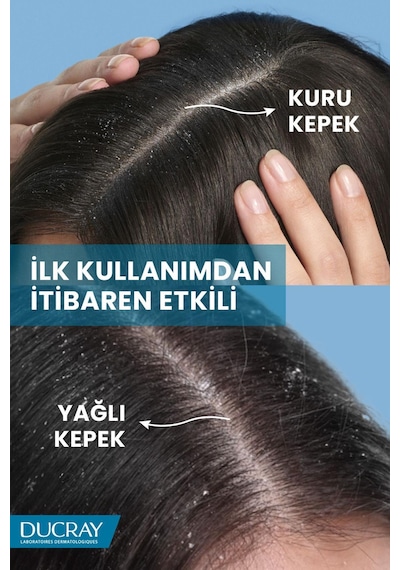 Ducray Kelual Squanorm Kepek Karşıtı Losyon 200 Ml