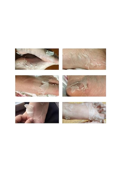 Ayak Peeling Maskesi Nasır, Ölü Deri Temizleyici, Nemlendirici Özellik, Lavanta Yağı Ve C Vitamini İçerir