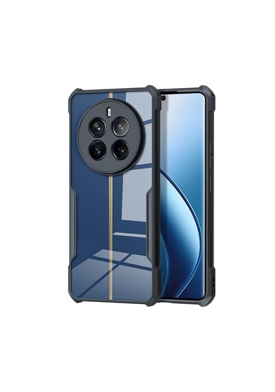 Realme 12 Pro/12 Pro Plus Airbag Tpu Kılıf-al3370