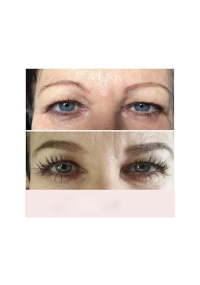 Hairplus X10lash Kirpik Ve Kaş Serumu 01 Açık