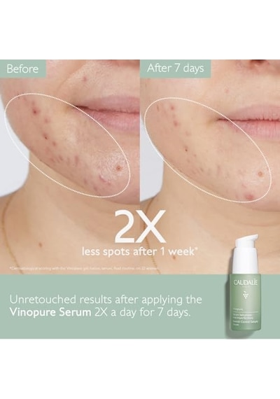 Caudalie Vinopure Blemish Control Salicilic Serum - 30ml