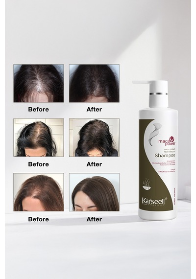 Anti Hair Loss Dökülme Önleyici Şampuan 500 Ml - 705279179 Tüm Saç Tipleri
