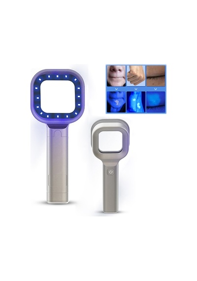 Wood Işığı Dermatolog Güzellik Merkezi Uv Cilt Analiz Cihazı