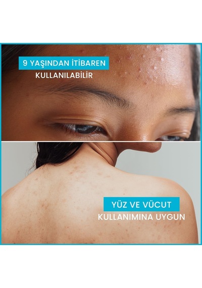 Tr Keracnyl Gel Moussant 400 Ml Yüz Temizleme Jeli