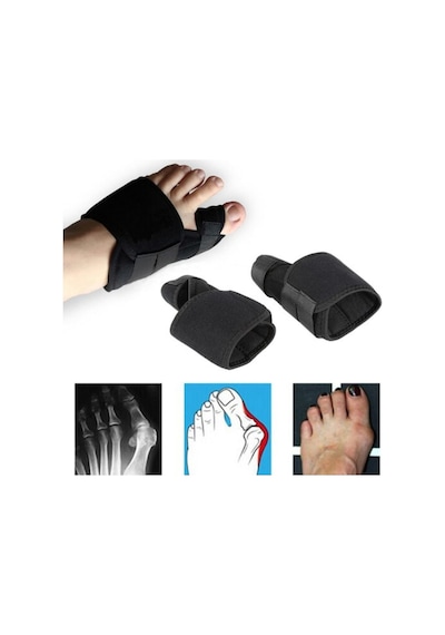 Medikal Halluks Valgus Gece Ateli Düzeltici Ayak Baş Parmak Kemiği Çıkıntısı Bunyon Kemik Koruyucu